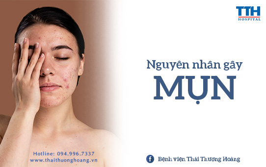 NGUYÊN NHÂN GÂY MỤN VÀ CHĂM SÓC DA ĐÚNG CÁCH